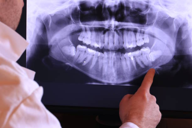 Best Walk-In Emergency Dentist in Russellville, AR