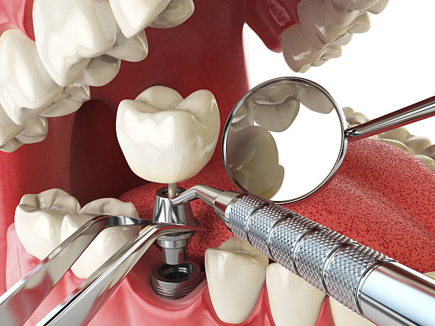Best Emergency Dental Surgery in Russellville, AR