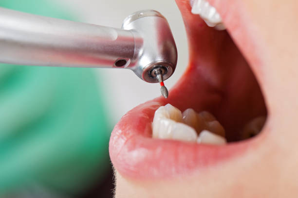 Best Emergency Broken Tooth Repair in Russellville, AR